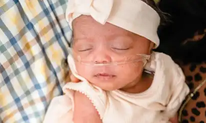 A newborn baby wearing a headband and dress, with an oxygen tube in her nose