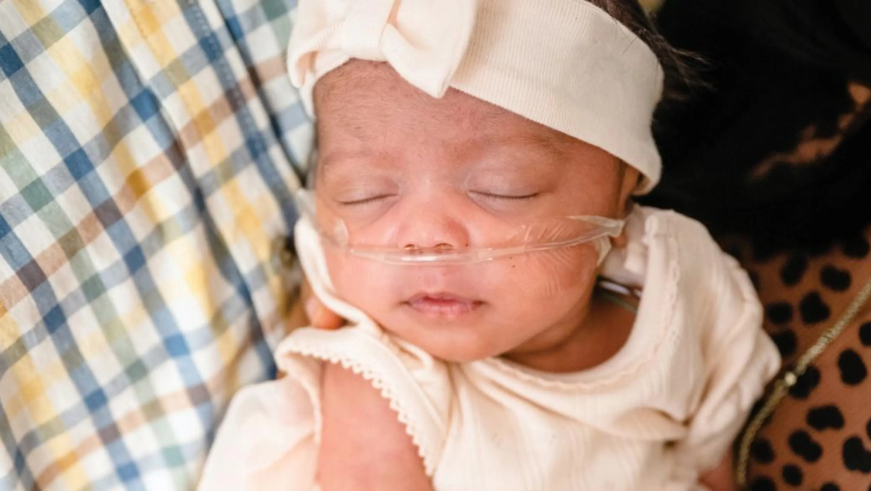 A newborn baby wearing a headband and dress, with an oxygen tube in her nose