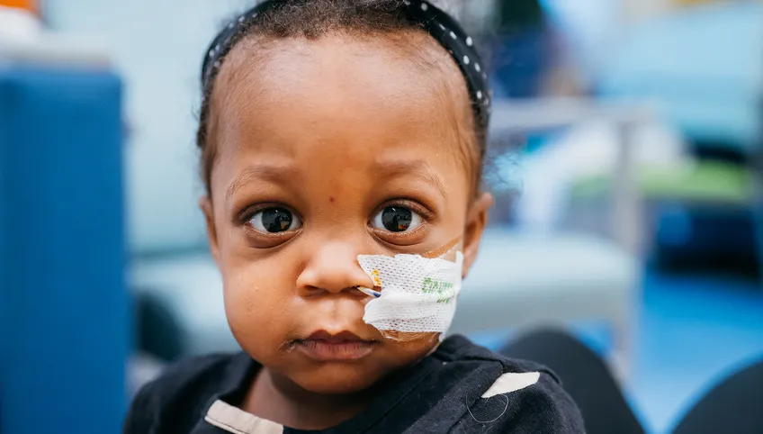 small child looking straight on with a breathing tube taped to her face