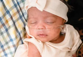 A newborn baby wearing a headband and dress, with an oxygen tube in her nose